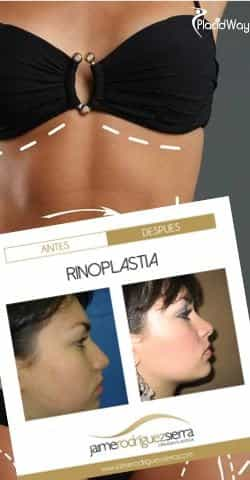 Cosmetic Surgery in Mexico